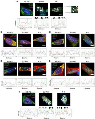 Differential Targeting of Hsp70 Heat Shock Proteins HSPA6 and HSPA1A with Components of a Protein Disaggregation/Refolding Machine in Differentiated Human Neuronal Cells following Thermal Stress